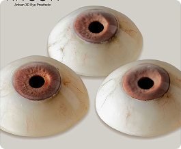 Protesa Mata 3D Realistis – Custom Ocular Prosthesis